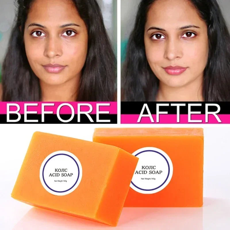 100G Kojic Acid Skin Lightening Soap with Glutathione Handmade Brightening Bleaching Soap for Face 3 Color Options Available