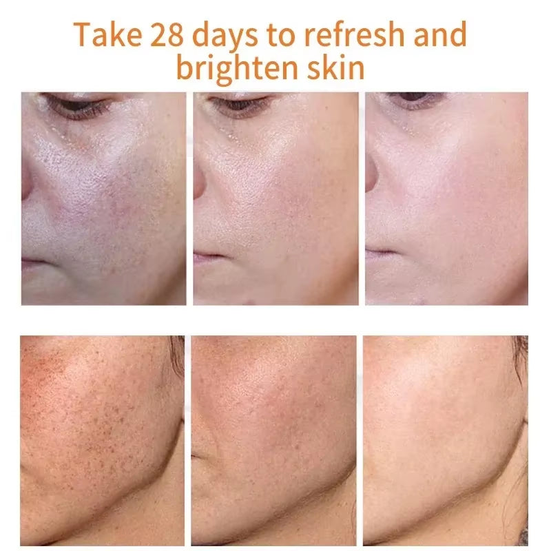 Whitening Freckle Cream Remove Dark Spots Remove Melasma anti Freckle Cream Fade Pigmentation Anti-Aging Light Skin Care