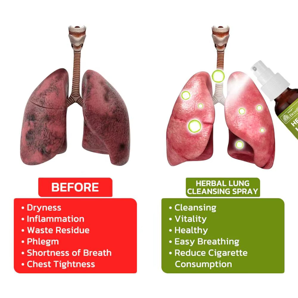 Herbal Lung Cleansing Spray Breath Detox Herbal Lung Cleanse Spray, Herbal Lung Cleanse Mist - Powerful Lung Support